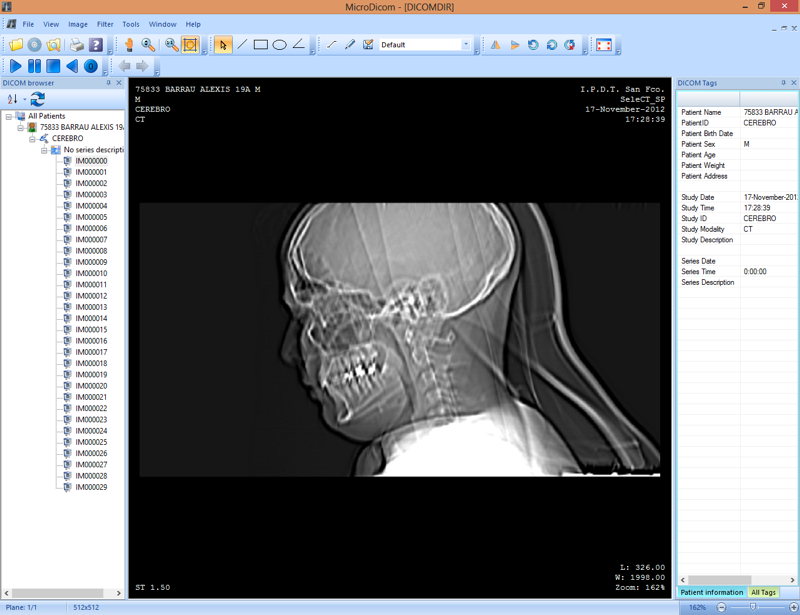 Sante DICOM Viewer Pro 12.2.5 download the new